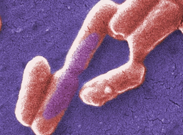 Gram-negative Escherichia coli, or E Coli, bacteria, as seen under a microscope