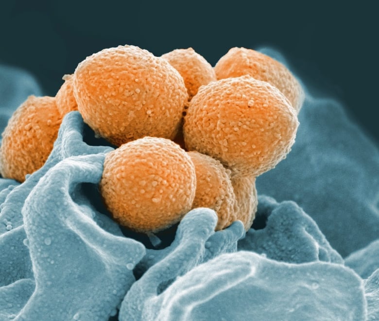 An electron microscope image shows group A streptococcus during phagocytic interaction with a human neutrophil.