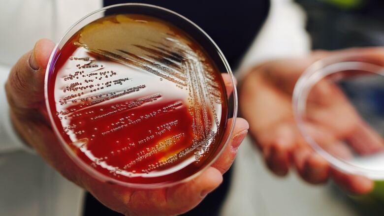 A petri dish in the palm of someones hand. 