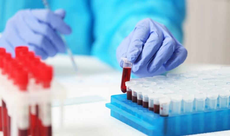 A worker handles vials of blood.