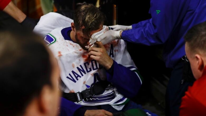 In this 2019 photograph, Vancouver Canucks' Alexander Edler is bleeding and holding his head after he is helped off the ice after a head injury during an NHL hockey game against the Philadelphia Flyers, on Feb. 4, 2019, in Philadelphia. 