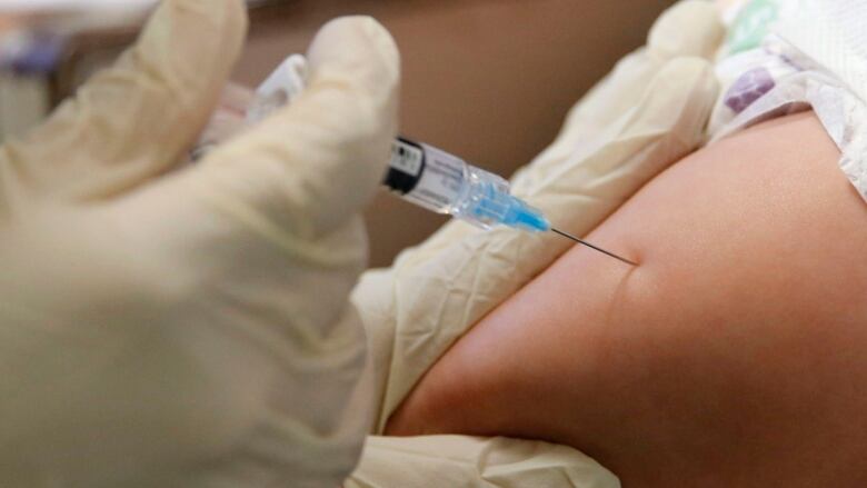 A needle is jabbed into an arm. 