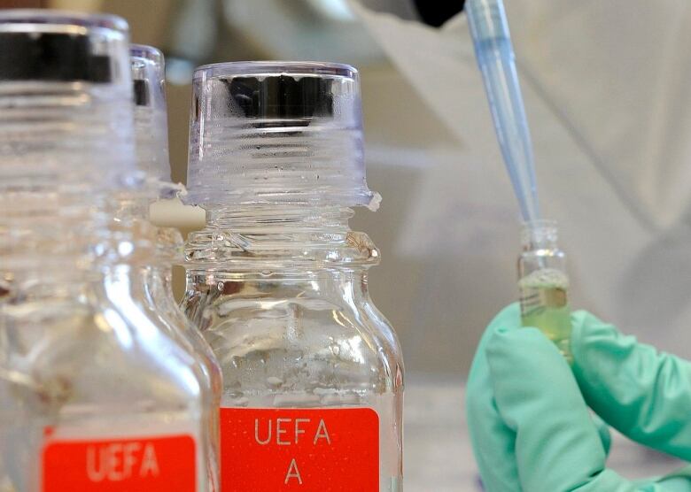 Gloved hands draw liquid from a glass vial using a pipette.