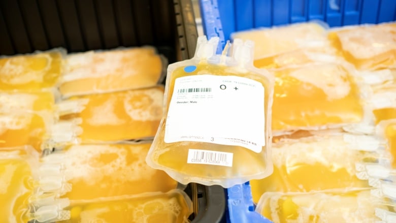 Yellow liquid in a medical bag.