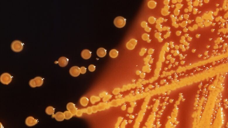 Bacteria grows on a petri dish. It is yellow and there's red lighting in the background. 