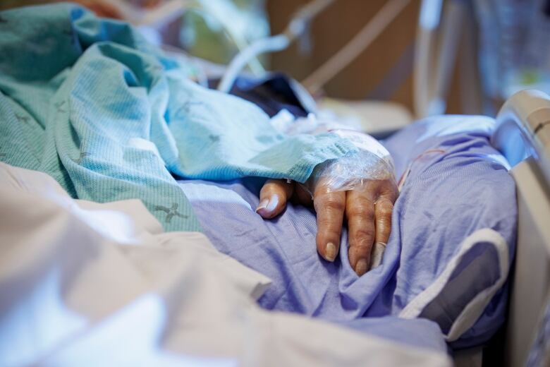 The hand of a COVID-19 patient on a ventilator is pictured in the intensive care unit of Humber River Hospital, in Toronto, on Jan. 25, 2022.