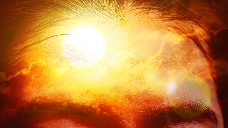 Forehead with sun superimposed on top of it.