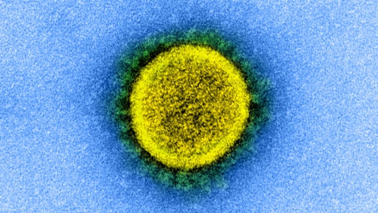 A yellow microscope image of a virus.