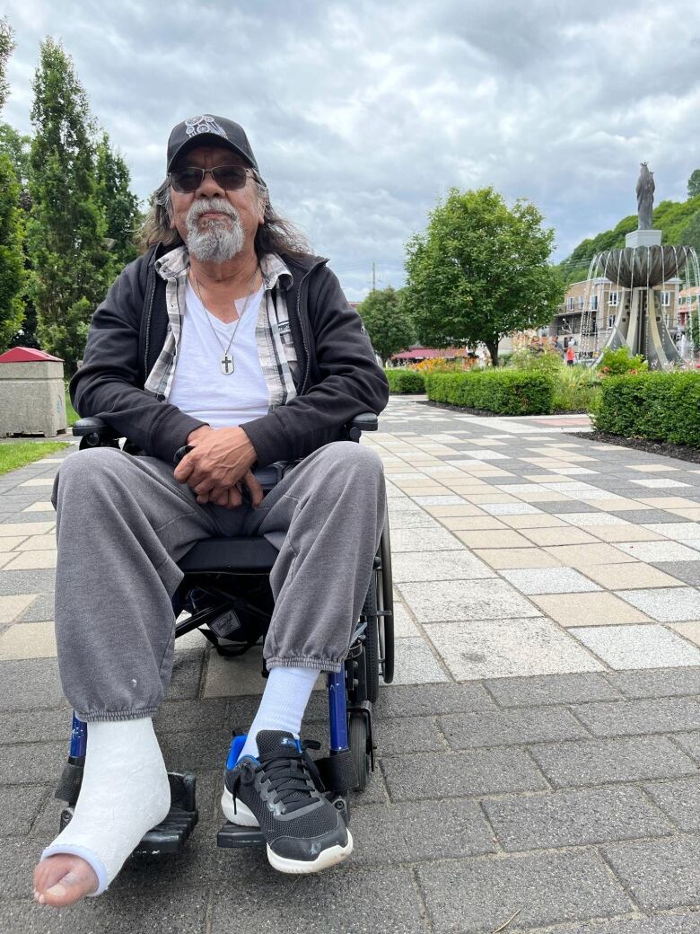 A man sits in a wheelchair with a cast on his left foot.