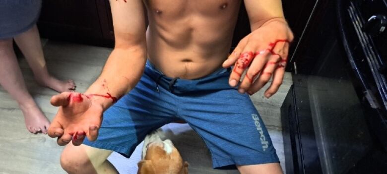 Joel shows his bloodied hands. He is shirtless and wearing blue shorts.