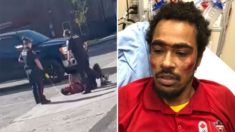 On the left, officers stand and hold a Taser near a man lying on the ground. On the right, A man sits in a hospital bed with a bruised face.