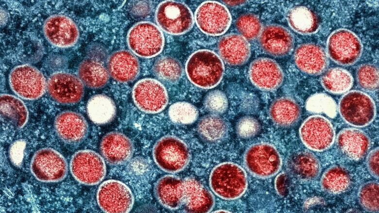 A colourized transmission electron micrograph of monkeypox particles (red) found within an infected cell (blue).