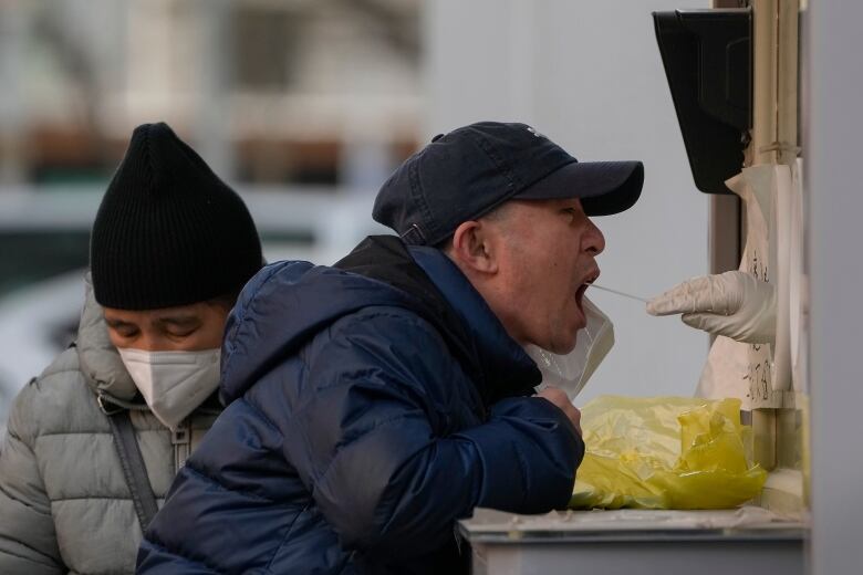 A man opens his mouth for a COVID-19 swab test.