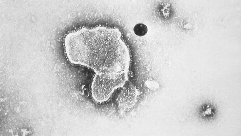 A picture of the respiratory syncytial virus taken via electron micrograph.