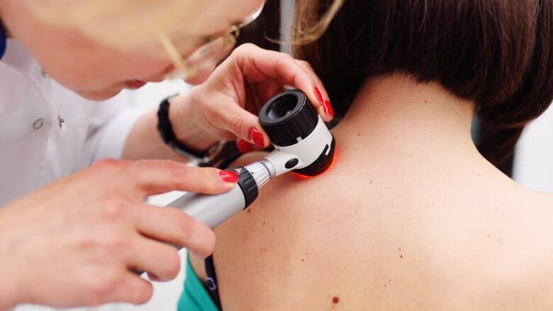 A dermatologist uses a tool called a dermatoscope to examine a mole on a woman's back.