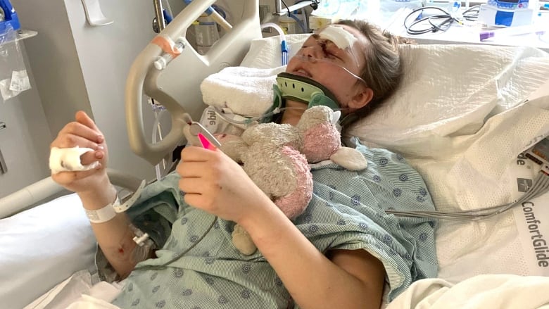 A young woman lays in a hospital bed. She is wearing a hospital gown, neck brace, and has bandages on her face. She is hooked up to tubes and cords. She attempts to do two thumbs up.