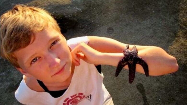 A person with a starfish on their arm looks up at the camera.