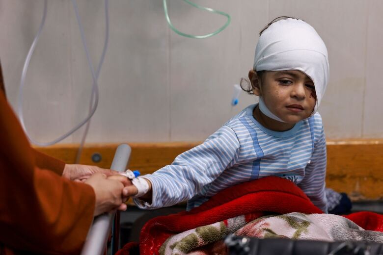 A child with a bandaged head holds the hand of an adult while sitting in a hospital bed.