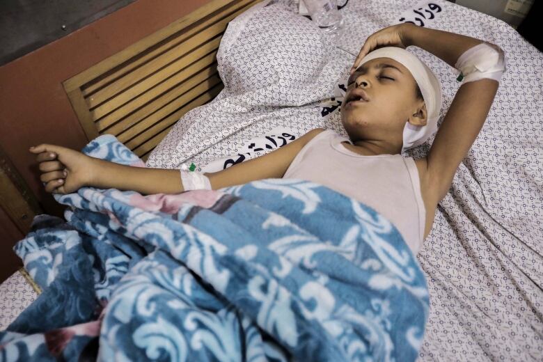 A little boy lies in a hospital bed with bandages on his arms and head.