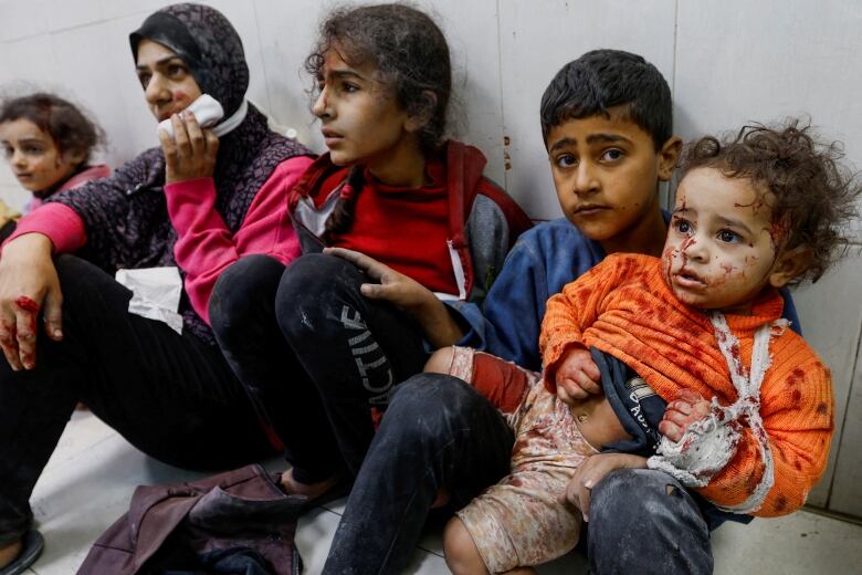 Children and a woman with blood on their faces sit on the floor at a Gaza hospital.