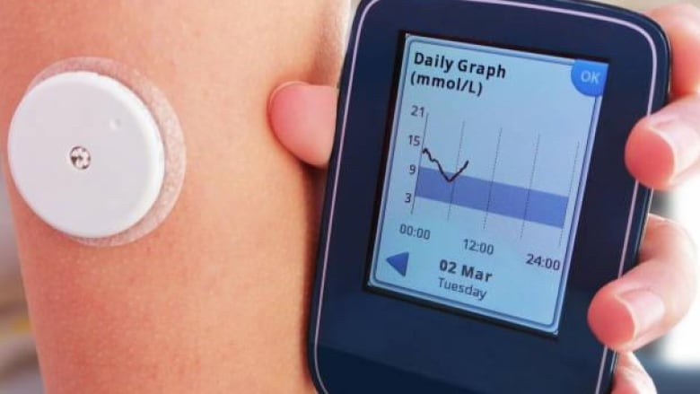 Continuous glucose monitors or CGM with sensor and screen displaying graph of levels.