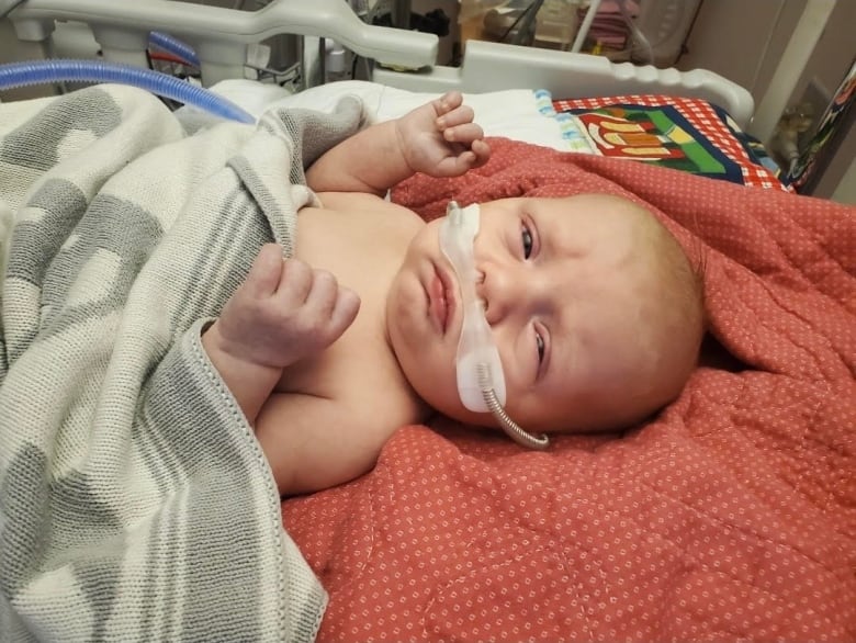 A male infant in a hospital bed with breathing tubes in his nose.