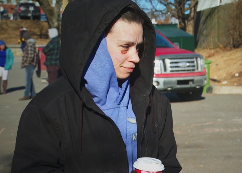 A woman with a black eye and a black jacket stands in a parking lot holding a coffee cup. 