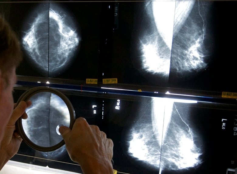 radiologist looks at mammogram