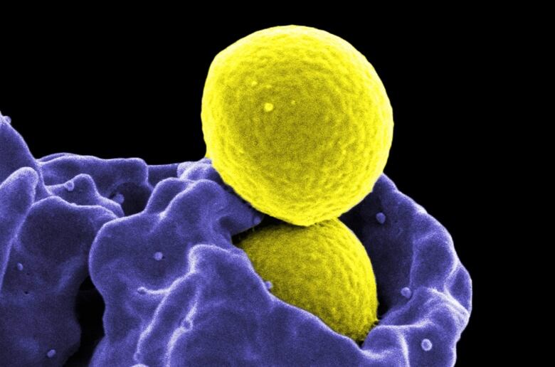 Digitally colourized, scanning electron microscopic (SEM) image, depicts two, yellow-colored, spherical, methicillin-resistant, Staphylococcus aureus (MRSA) bacteria, that were in the process of being phagocytized by a blue-colored human white blood cell (WBC), known specifically as a neutrophil.