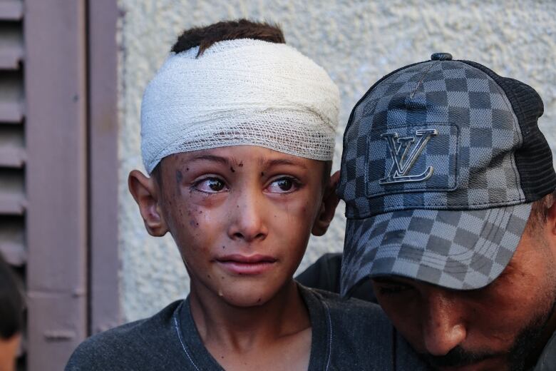 A child with a bandaged head cries as they are comforted by an adult.