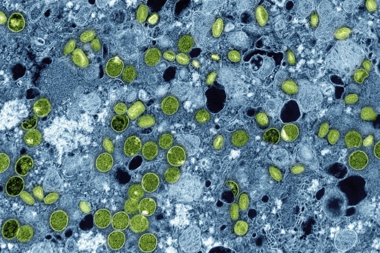 A colourized electron microscope image provided by the U.S. National Institute of Allergy and Infectious Diseases in 2024 shows Mpox virus particles, green, found within infected cultured cells, blue.