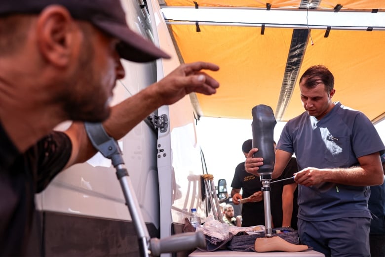 An amputee looks on as a new prosthetic limb is prepared.