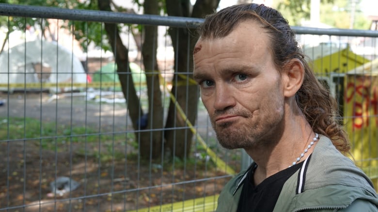 A man with a ponytail and scars on his face stands in front of a fence. Police tape and a tent can be seen in the background.